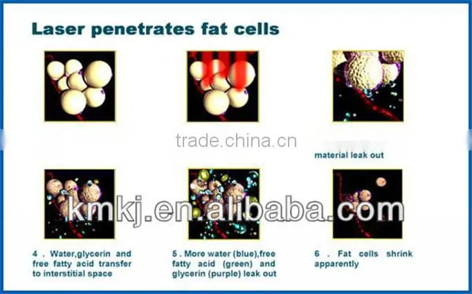 Cheap and manufacture slimming laser