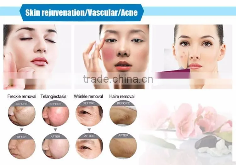 2017 New portable multi-function beauty machine with personal ipl machine