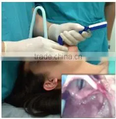 Uheal anesthesia intubationscope instrument airway management endoscope