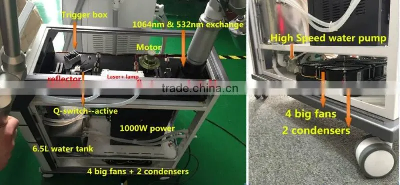 Alibaba in spanish wholesale tattoo removal yag laser q switched nd yag laser/tattoo aesthetic laser
