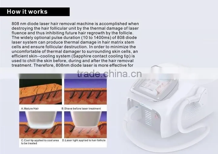 Hot newest Germany 808nm diode laser hair removal beauty machine---DIDO-II