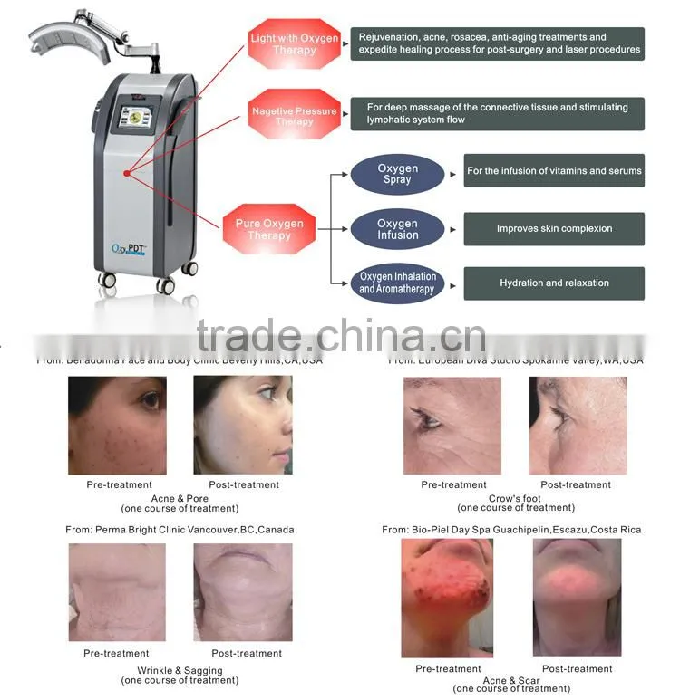 Professional Oxygen Therapy Equipment and PDT Beauty Machine for All Skin Care