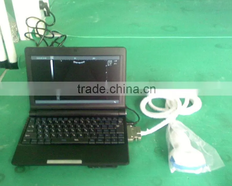 FN530 HOT selling full digital laptop ultrasound equipment