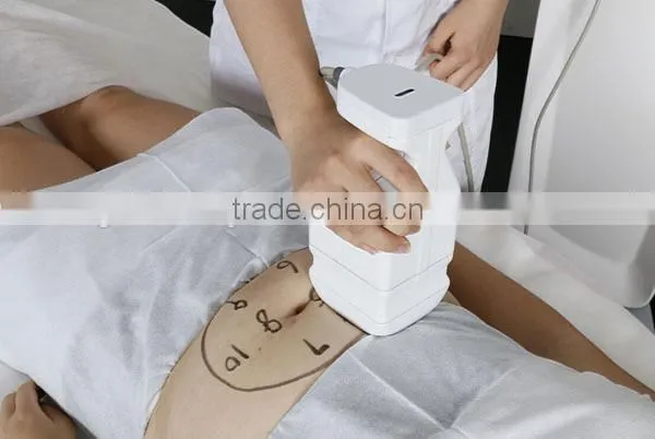 hifu slimming machine 2016