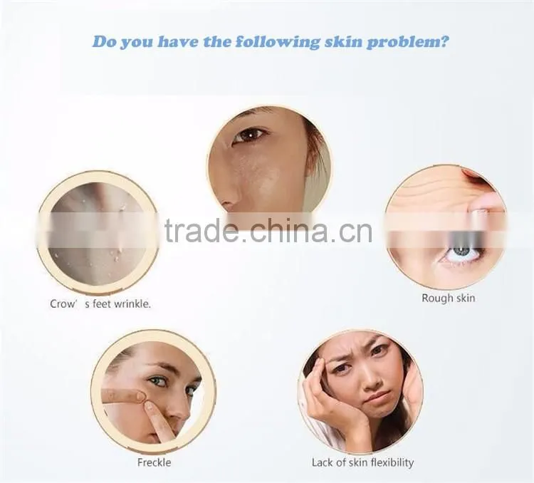 wholesale price nose blackhead remover/blackhead remover