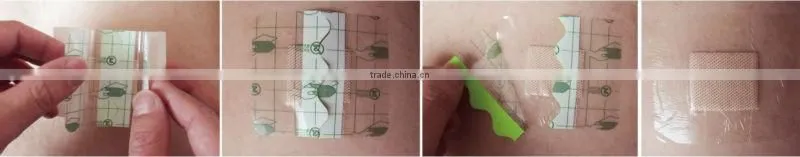 PU wound dressing