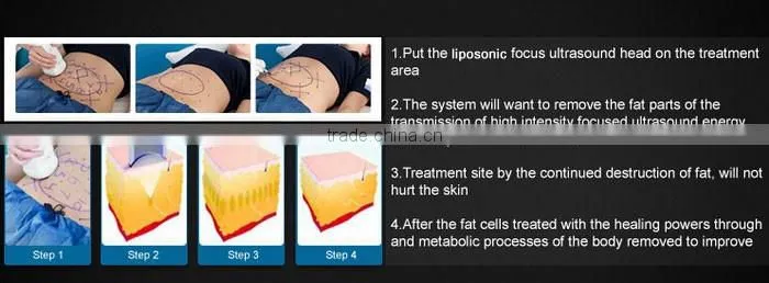 home use fat reduction liposunic machine