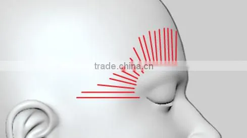 CE Certificated HIFU portable machine/korea/body/face lift Belle-HIFUhifu high intensity focused ultrasound