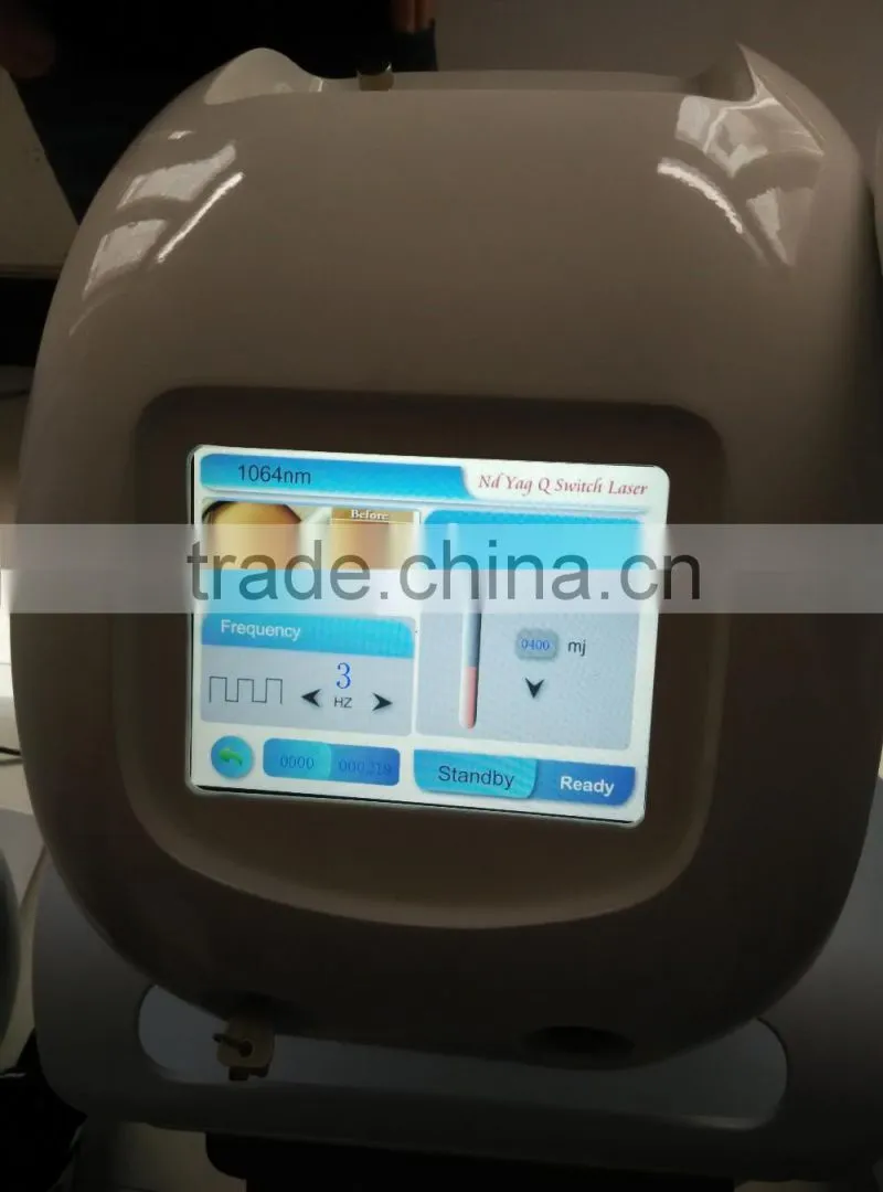 tattoo removal q switched erbium yag laser/ portable nd yag laser for tattoos removal