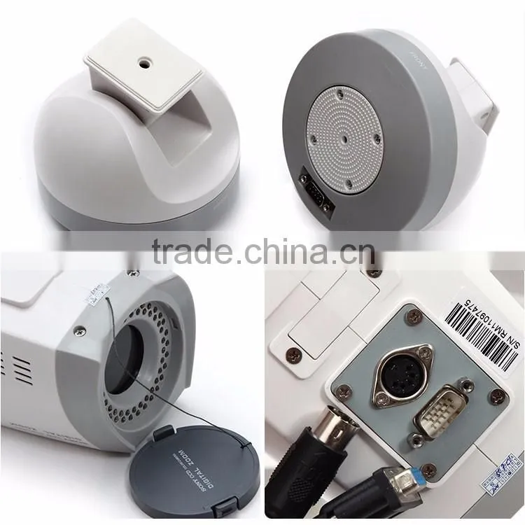 OEM/ODM Factory price Whtie color 10mm ~400mm portable digital video colposcope