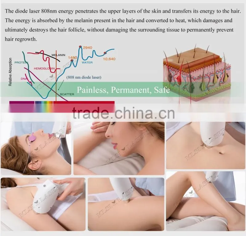 Germany laser bar technology hair removal machine 808 diode laser