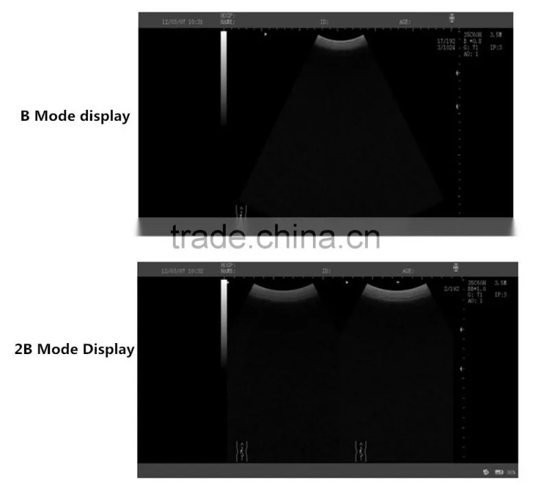 CE Full Digital Medical Ultrasound for animal