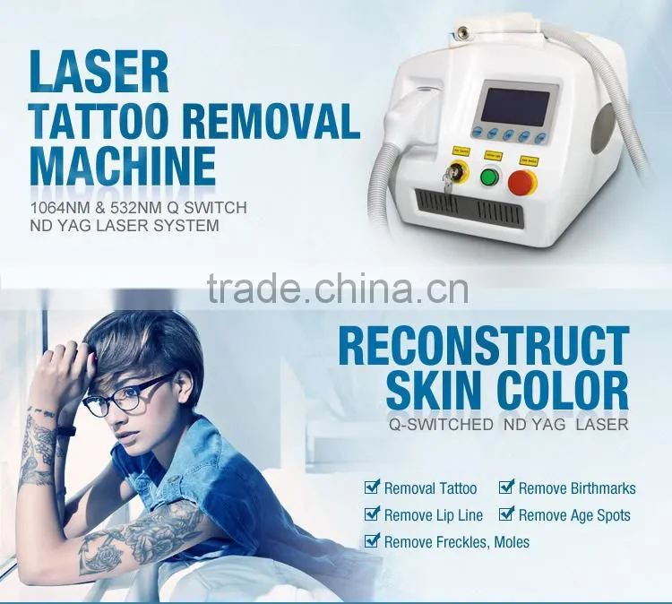 2016 latest laser softlight nd yag laser 1064 nm wavelength tattoo removal machine