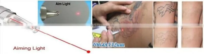10 hz nd yag laser for tattoo removal 1320nm diy yag laser beauty machine