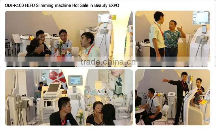 25%OFF! 2015 Supersonic fast weight loss hifu body shape OD-R100