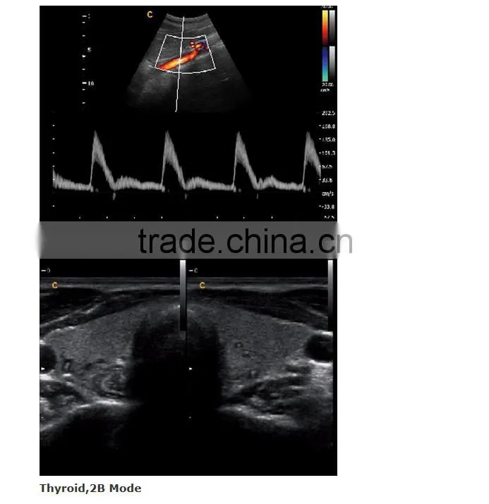 2016 new Portable Color Doppler(Optional 4D) for cardiac use
