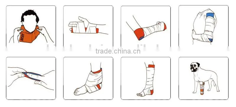 IXPE ALuminum thermoplastic confortable finger splint
