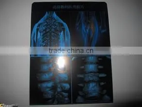 Agfa film agfa dry films agfa x-ray film