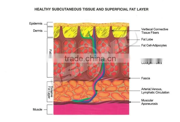 LM-E300A Portable skin tightening radio frequency body machine