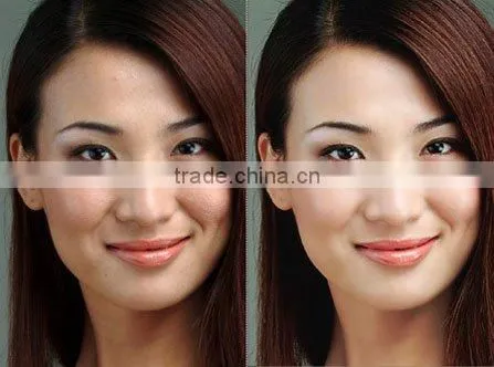 3 in 1 Ultrasonic Diamond Dermabrasion +Hot & Cold Theraphy +Skin Scrubber