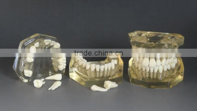 Dental detachable transparent dentition model DEA-47