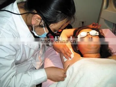 ipl elight/ndyag laser
