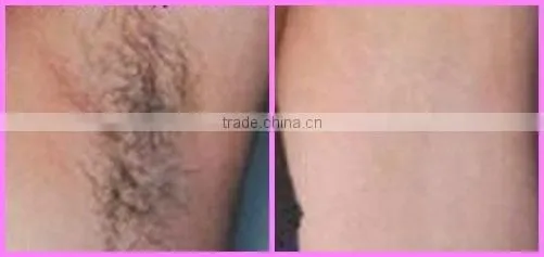 e light facial beauty salon equipment