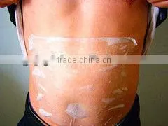 2015 top consumable beauty products vacuum lifter Cryo-1 cellulite removal machine for sales