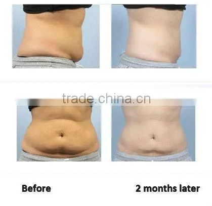 2014 New ultra lipo cavitation+rf beauty slimming machine with CE