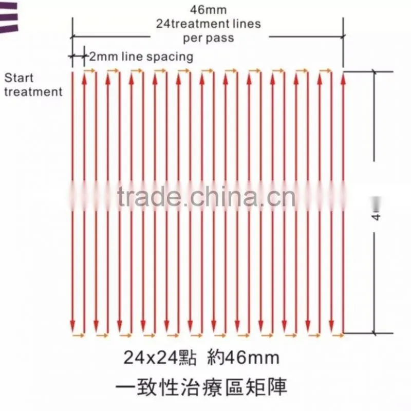 IF13 resultful non-invasive ultrasonic lipolysis hifu body contour slimming price