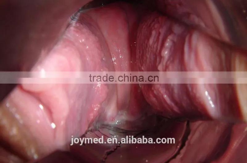 Self Exam Colposcope