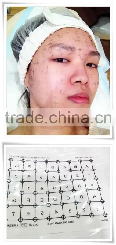 Fractional rf machine with led light for face lifting G-209B