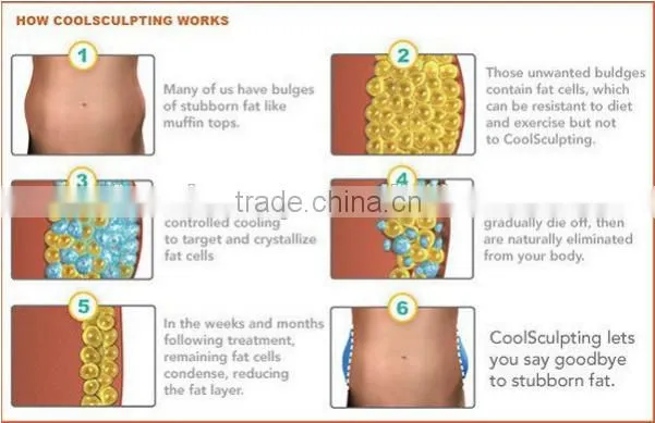 criolipolysis fat freeze body cool sculpting machine/cryotherapy weight loss