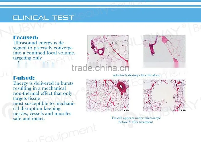 Hot Sales ! MIni Portable Home HIFU Liposuction Fat Reduction Ultrasound Machines