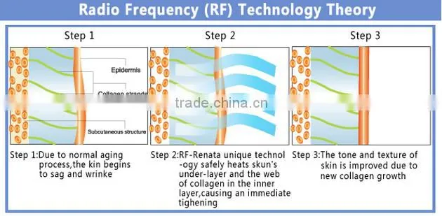 5MHZ RF for face lifting and skin tightening beauty instrument