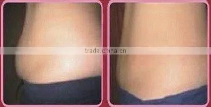 Vacuum And Ultrasonic Cellulite Reduction Cavitation(desktop)