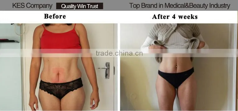 Vacumm fat freezing machine