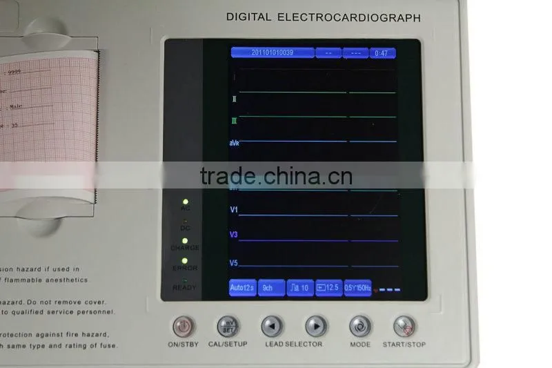 Digital Three Channel 12 lead ECG Machine--CE FDA Approved color Echocardiogram