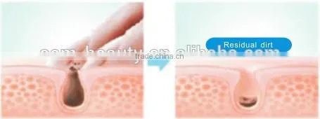 Electric facial cosmetic cleaner,face skin cleaning brush with best design -JTLH-1501