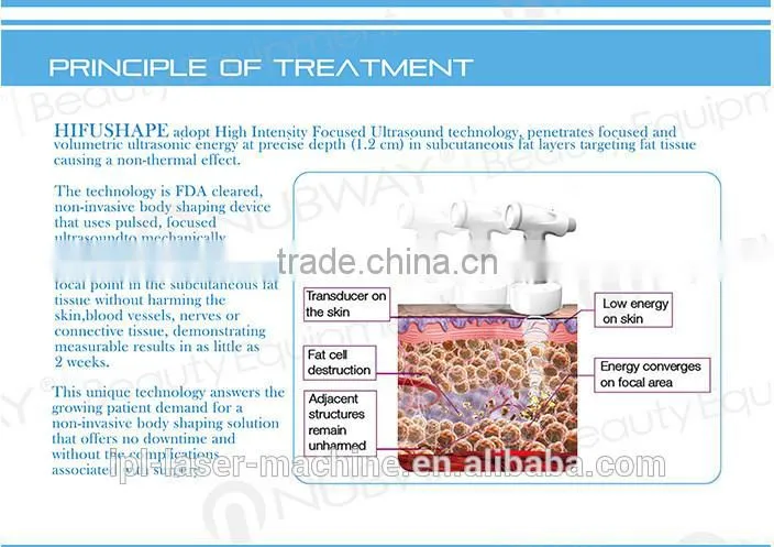 men use High Intensity Focused Ultrasound body shape machine/HIFUSHAPE ultrasonic liposuction