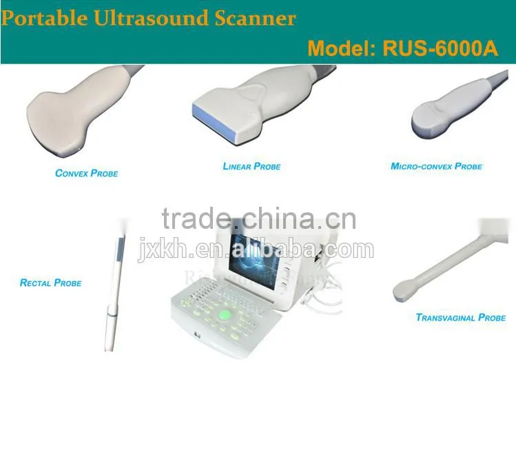 1 USB factory price OEM design 80 elements R60 ultrasound scanner for pregnancy