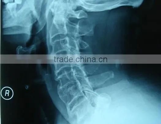 medical thermal x-ray film 14x17 with CE license and ISO 13485