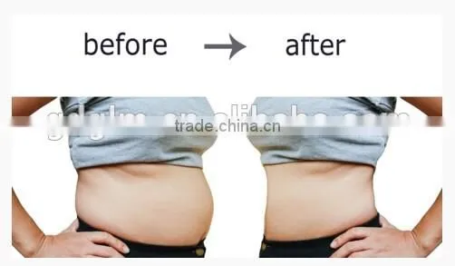Christmas promotion! ultrashape cavitation RF liposuction slimming machine