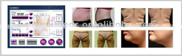 body shaping machine for cavitation