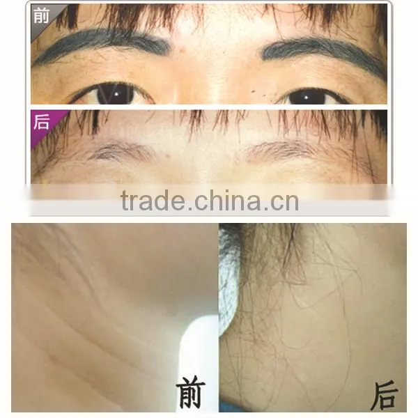 GGLT multifunctional beauty health hair removal for body and face