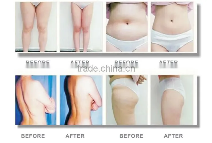 Newest body shaping machine vertical vacuum roller slimming machine