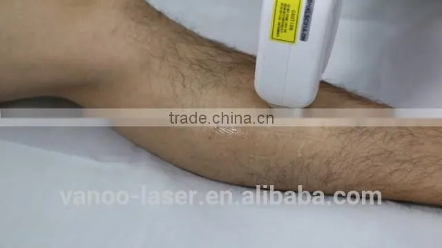 vanoo Laser 808nm hair removal diode laser machine , cost effective