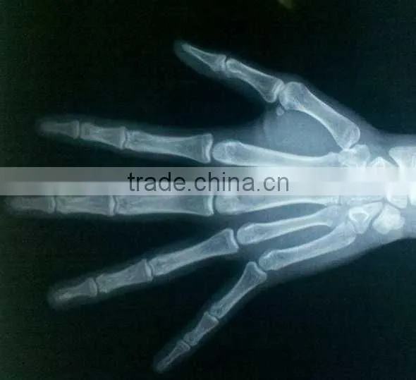 Konida medical x-ray film agfa fuji dry film/x-ray automatic medical film processor