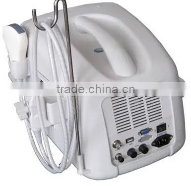 MCSS-6Portable Ultrasound Scanner portable ultrasound machine color dopler