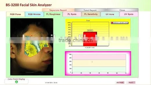Newest 3D magic mirror visia skin analysis machine